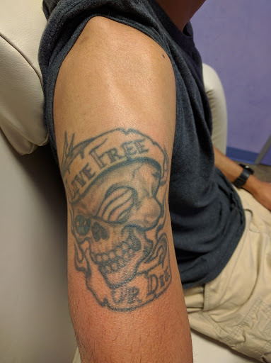 Explore arm tattoo placement ideas, creative tattoo ideas in Colleyville, available at DFW Tattoo Removal