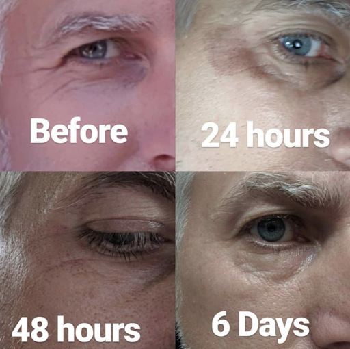 Explore father and son tattoos ideas, creative tattoo ideas in Roseville, available at NuHair Ink. Scalp MicroPigmentation & Aesthetic Clinic of Sacramento