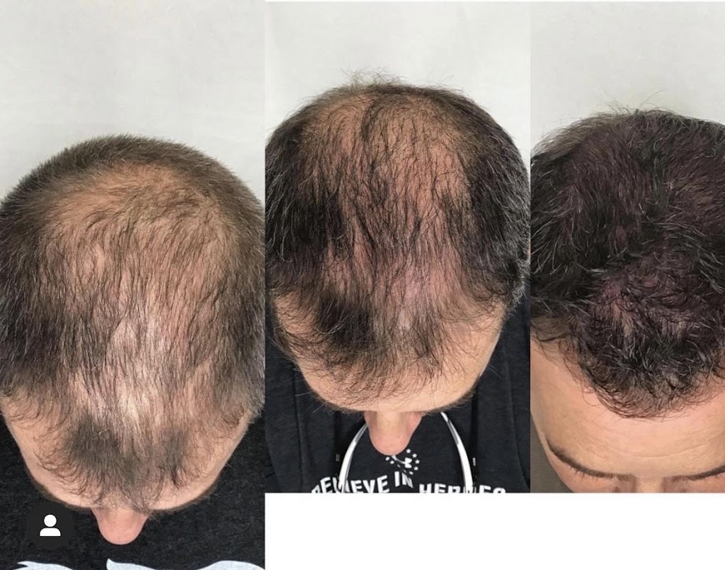 RNA Medical Aesthetics 37604