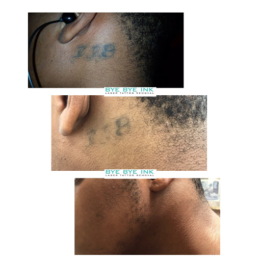 Explore full leg sleeve tattoo ideas, creative tattoo ideas in Middle Village, available at Bye Bye Ink Laser Tattoo Removal