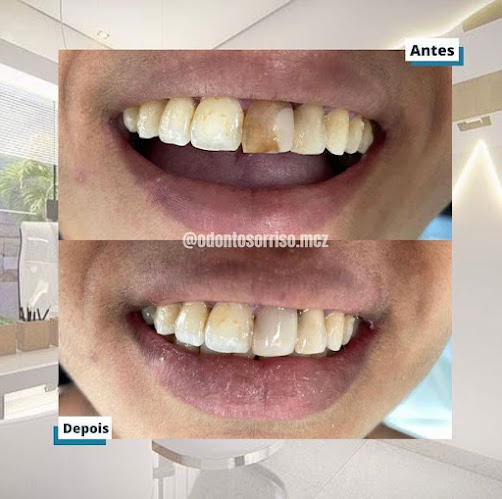 Odonto Sorriso - Dentista