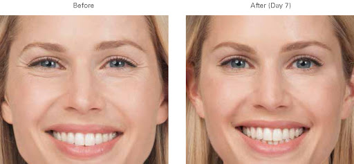 Explore tattoo name placement ideas, creative tattoo ideas in Boise, available at Spa 35 Med Spa