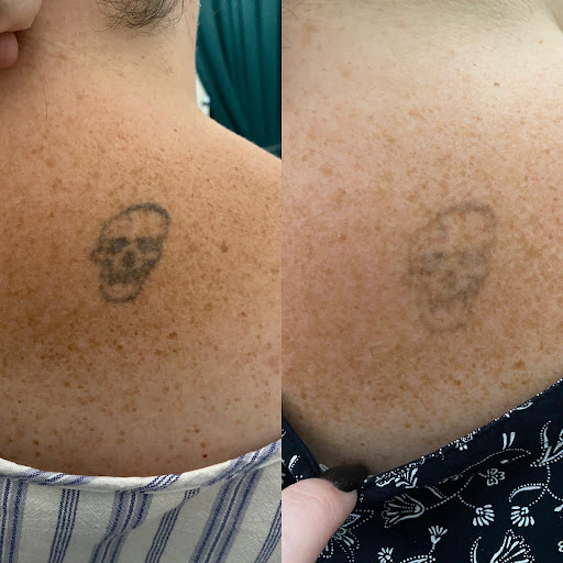 Find good leg tattoo ideas for your next unique tattoo in Lake Jackson at Second Chance Laser Tattoo Removal