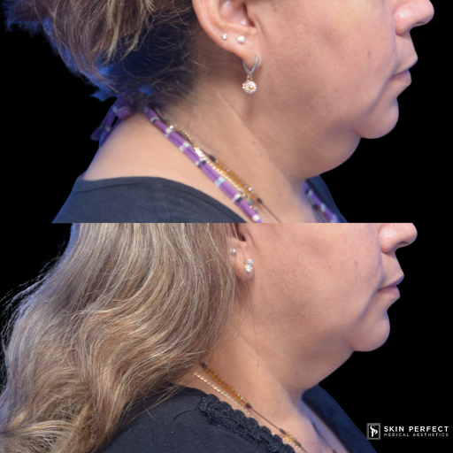 Explore ghetto tattoo ideas, creative tattoo ideas in Whittier, available at Skin Perfect Medical Aesthetics