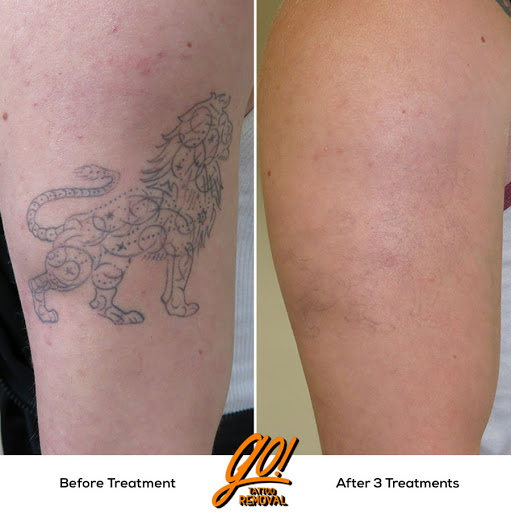 Explore shipwreck tattoo ideas, creative tattoo ideas in Allentown, available at Removery Tattoo Removal & Fading