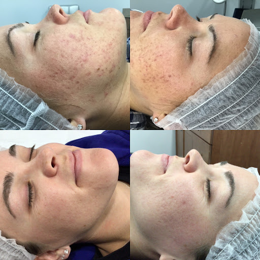 Find crystal tattoo ideas for your next unique tattoo in Ambler at Strella Medical Aesthetics
