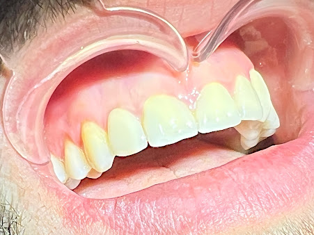 BL Dental - BL Dental