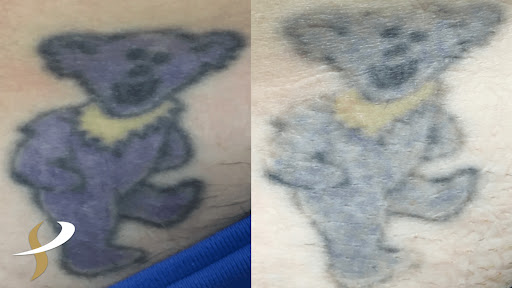 Explore latitude longitude tattoo ideas, creative tattoo ideas in Spokane, available at Premier Body and Laser