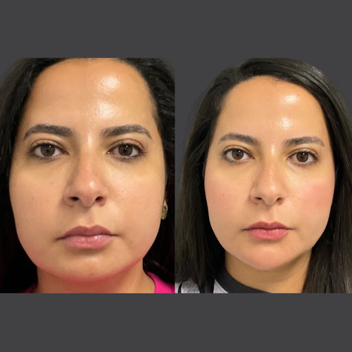 Explore cape verde tattoo ideas, creative tattoo ideas in Whittier, available at Skin Perfect Medical Aesthetics