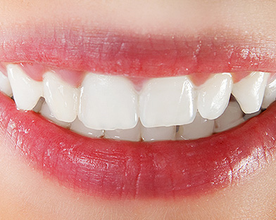 Reviews of White Pearl Dental Practice in Birmingham - Dentist