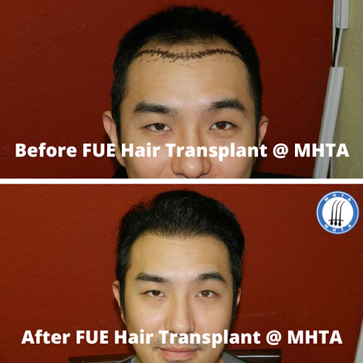 Hair Replacement Service «Medical Hair Transplants & Aesthetics», reviews and photos, 15055 Los Gatos Blvd Suite #110, Los Gatos, CA 95032, USA