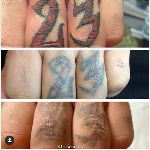 Explore tattoo ideas for men's back, creative tattoo ideas in Naples, available at Laser Tattoo Removal Services