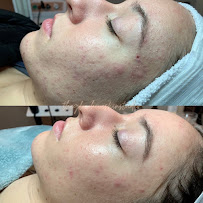 The Glowhive Skin Studio - Photo 7 - Car repair in Waco, TX, Waco