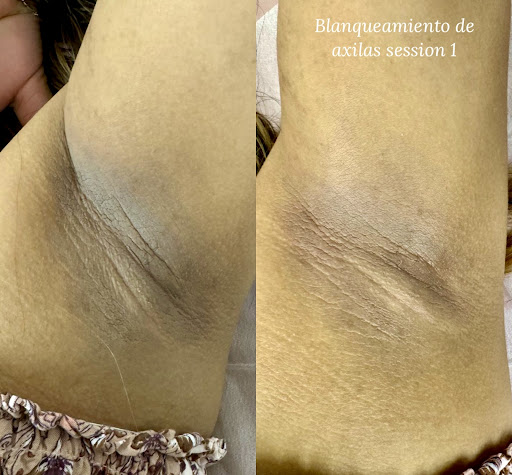 Explore butterfly tattoo placement ideas, creative tattoo ideas in Savannah, available at Haute Brows. Cosmetic Tattoo