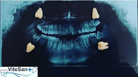 Clínica Odontológica ViteDent
