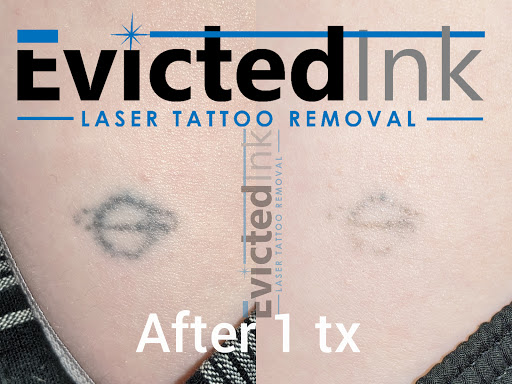 Explore scream tattoo ideas, creative tattoo ideas in Wichita, available at Evicted Ink Laser Tattoo Removal
