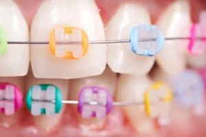 Comfort Dental Clinic & Orthodontic Center image