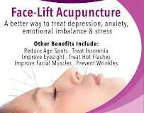 Doctor Lam Acupuncture Center - Photo 9 - Car repair in Glendale, CA, Glendale