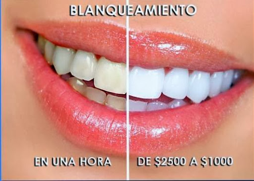 Dentistas en Puebla Clinica Dental Spota