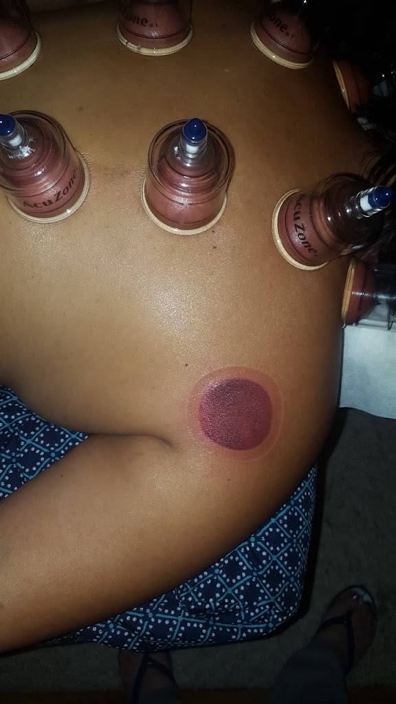 Carolena's Therapeutic Massage & Cupping Massage 92110