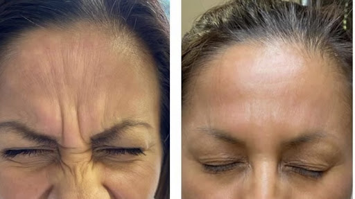 Laser Hair Removal Service «Refine Laser & Skin Care», reviews and photos, 7801 Park Dr, Chanhassen, MN 55317, USA