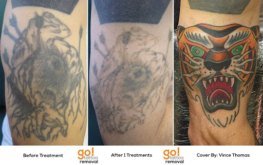 Find ideas for tattoos for moms for your next unique tattoo in Allentown at Removery Tattoo Removal & Fading
