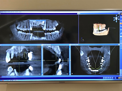 EspaiDental - Aleixandre Sanchis. Clínica Dental Picanya en Picanya, Valencia