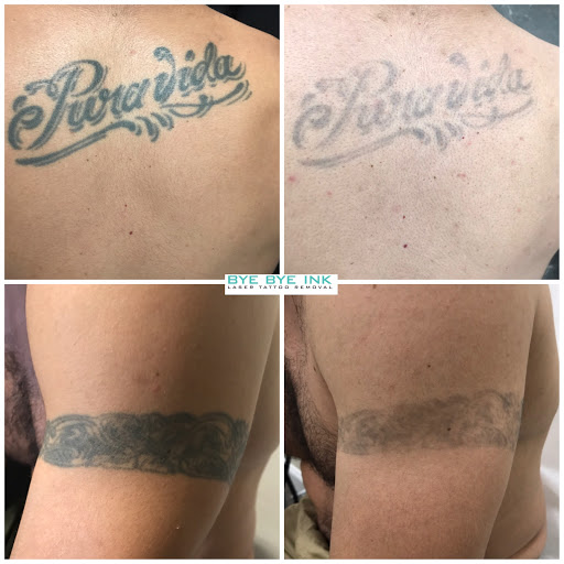 Explore tattoo ideas for name cover up, creative tattoo ideas in Middle Village, available at Bye Bye Ink Laser Tattoo Removal
