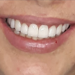 Primor Odontologia - Implantes dentários em Palmas - Dr. Juliano Guerra
