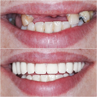 Vita Centro Implantologia Setúbal - Vita Centro Implantologia Setúbal