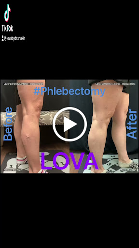 Explore tattoo idea legs, creative tattoo ideas in Lake Oswego, available at Lake Oswego Vein and Aesthetic LOVA