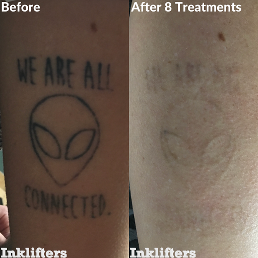 Explore sigil tattoo ideas, creative tattoo ideas in Pleasant Grove, available at Inklifters Tattoo Removal