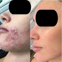 Silk Skin Laser Spa - Photo 2 - Car repair in Las Vegas, NV, Spring Valley