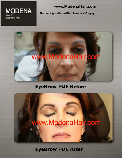Modena Hair Transplant Institute image