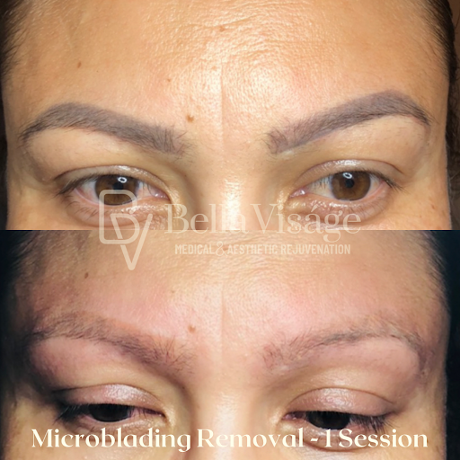 Explore the last of us tattoo ideas, creative tattoo ideas in Lakeland, available at Bella Visge Medical & Aesthetic Rejuvenation