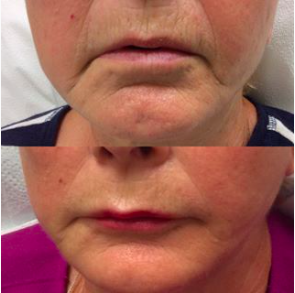 Explore rip tattoo ideas for brother, creative tattoo ideas in Lake Oswego, available at Lake Oswego Vein and Aesthetic LOVA