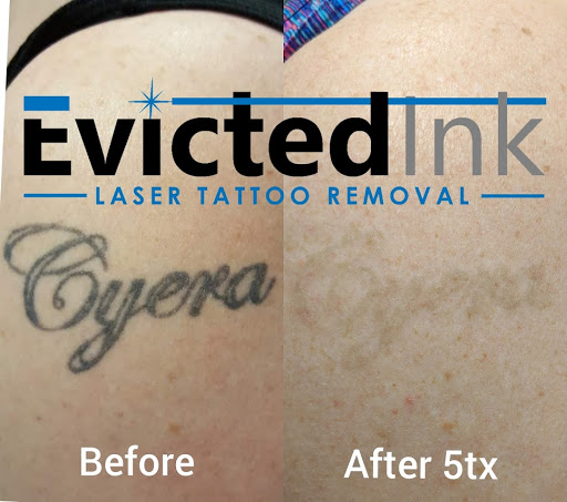 Explore 4 leaf clover tattoo ideas, creative tattoo ideas in Wichita, available at Evicted Ink Laser Tattoo Removal