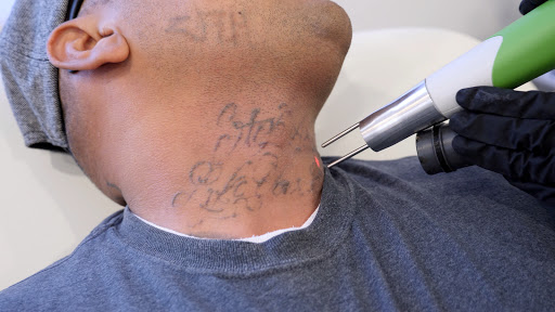 Explore rob zombie tattoo ideas, creative tattoo ideas in San Diego, available at Evolve Tattoo Removal