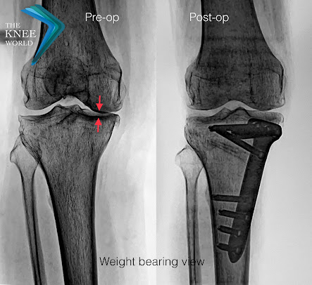 The Knee Klinik-Wanowrie - The Knee Klinik-Wanowrie