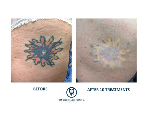 Explore women's wrist tattoo ideas, creative tattoo ideas in San Diego, available at Removery Tattoo Removal & Fading