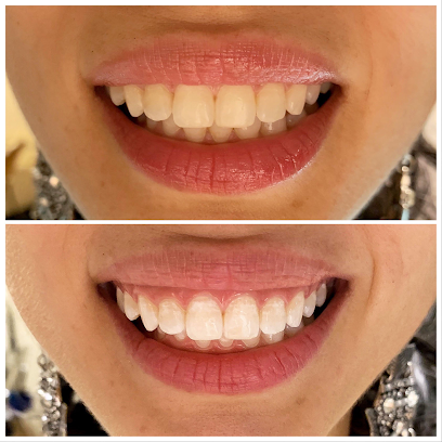 Brighten Your Smile - Teeth Whitening, Sutherland Shire