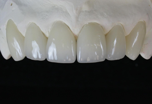 Moffat Dental Ceramics