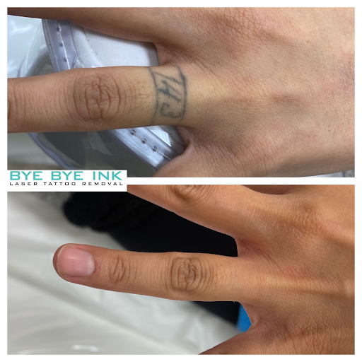 Explore trinidad tattoo ideas, creative tattoo ideas in Middle Village, available at Bye Bye Ink Laser Tattoo Removal
