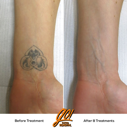 Explore floral sleeve tattoo ideas, creative tattoo ideas in Allentown, available at Removery Tattoo Removal & Fading