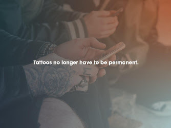 Removery Tattoo Removal & Fading