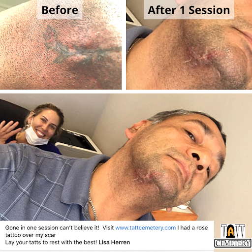 Explore mens tattoo ideas upper arm, creative tattoo ideas in Fort Myers, available at Laser Tattoo Removal by Tatt Cemetery