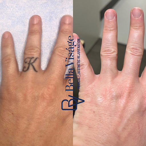 Find goth tattoo ideas for men for your next unique tattoo in Lakeland at Bella Visge Medical & Aesthetic Rejuvenation