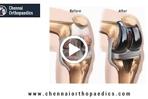 Dr Bharani Kumar D | Chennai Orthopaedics image