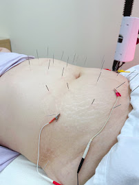 Prosperous Acupuncture Clinic - Photo 6 - Car repair in Pleasanton, CA, Hayward