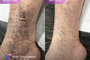 Vein Treatment Clinic image